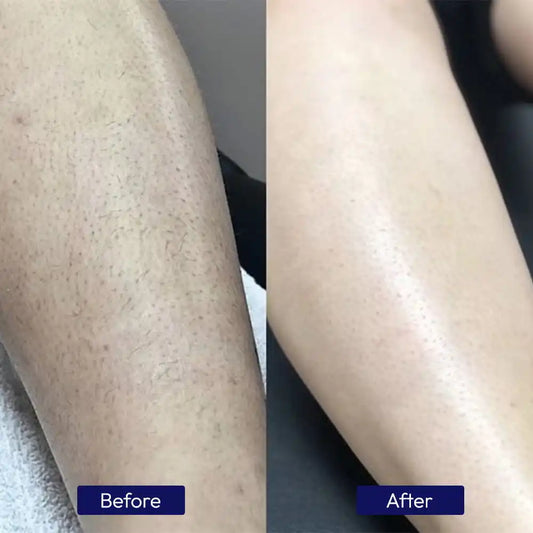 ZERO - HAIR INHIBITOR SERUM