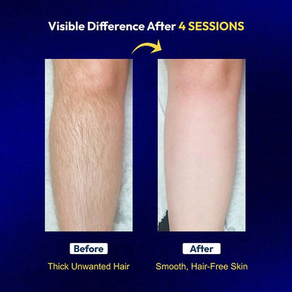 Zaisha Waxing & Zero Regrowth Kit